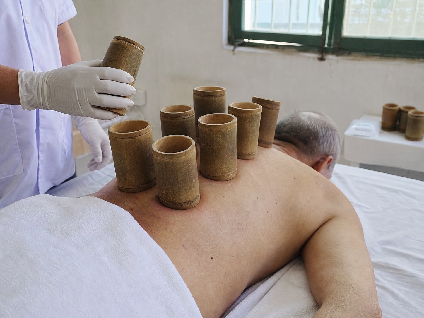 Традиционные бамбуковые банки Kim’s Clinic